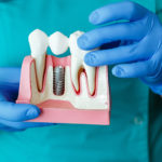 Choosing Expert Oral Surgery Care in Columbia MD: What Every Patient Should Know