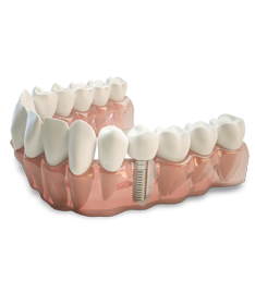 Which Types Of Cosmetic Periodontal Treatments In Columbia, MD Can I Get Treated With?
