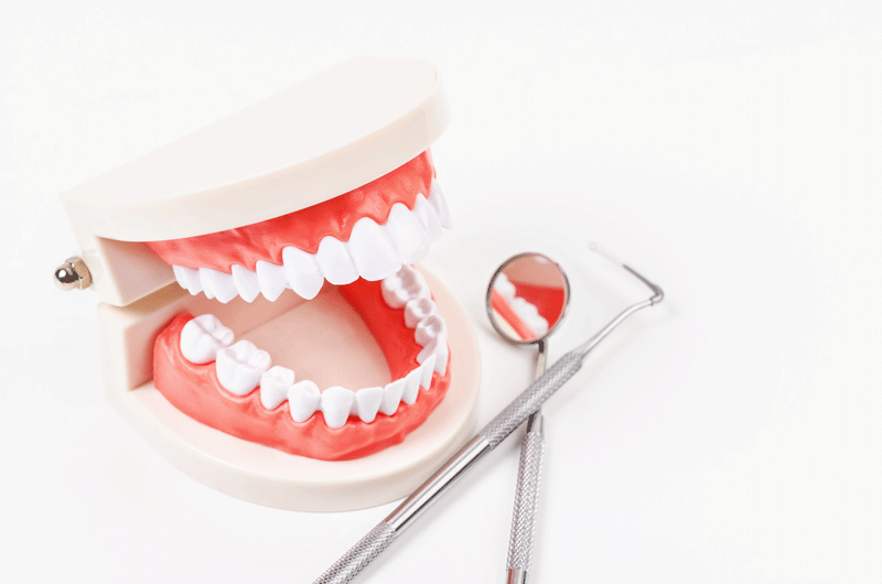 Who Is A Candidate For Dental Implants In Columbia, MD?