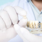 Can Anyone Have A Temporary Prosthesis Placed After Having Dental Implant Surgery?