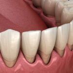 Find a Trusted Periodontist Specialist Near Me: Expert Guidance for Gum Health and More