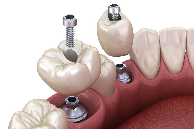 Finding Trusted Oral Surgeons: Your Guide to a Dentist Near Me in Columbia, MD