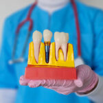 Exploring Your Options: Different Types of Dental Implants for a Confident Smile