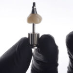 Expert Oral Surgeon's Guide to Dental Implants in Baltimore MD: What to Expect