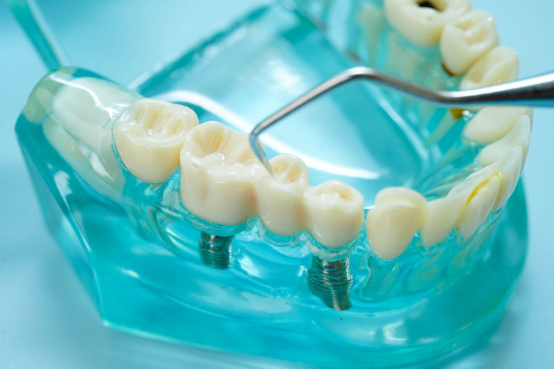 Expert Oral Surgical Care in Columbia MD: Finding Your Dentist Near Me