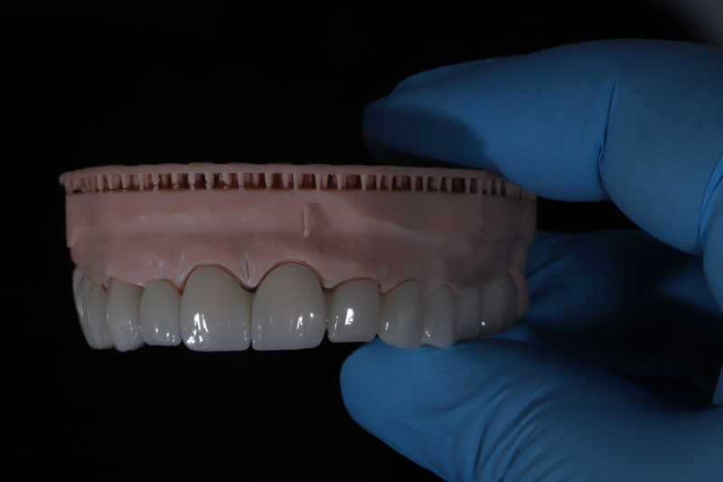 Understanding Periodontal Conditions and Oral Surgery in Baltimore MD: Your Comprehensive Guide