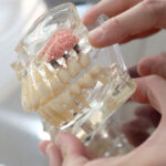 Advanced Oral Surgery Insights: Your Guide to Expert Columbia, MD Care